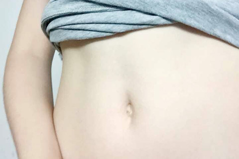 肚脐臭有分泌物，我们需要考虑是肚炎的缘故