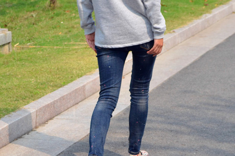 单纯的外痔很少会导致患者出现瘙痒的症状