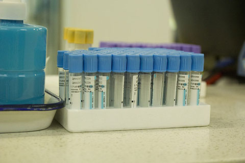 蛋白高的原因都有哪些