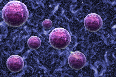 患有类风湿性关节炎、干燥综合征、系统性红斑狼疮等疾病,都会使抗核抗体显示为阳性 患有类风湿性关节炎、干燥综合征、系统性红斑狼疮等疾病,都会使抗核抗体显示为阳性