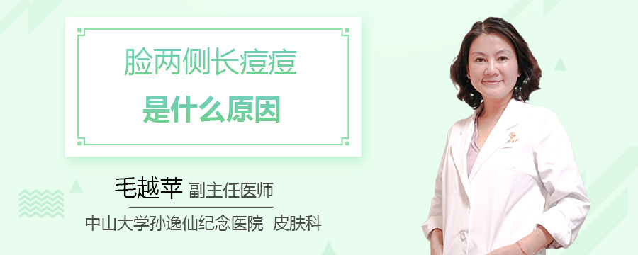 脸两侧长痘痘是什么原因