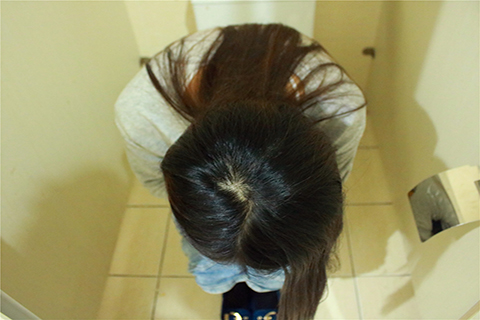 白带像豆腐渣是怎么回事