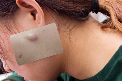 结节病是一种肉芽肿性疾病