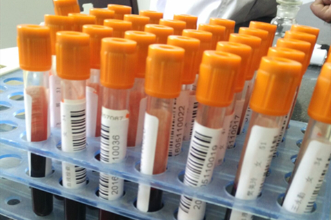 Hcg是人绒毛膜促性腺激素，是人体内胎盘滋养层细胞所分泌的一种激素