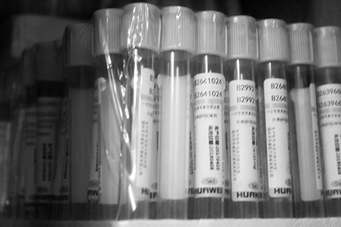 C反应蛋白对于多种疾病的诊断具有重要意义