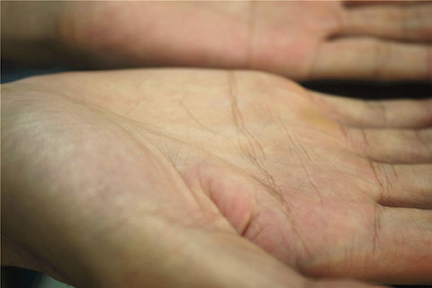 有了手掌发红的问题，不可以大意