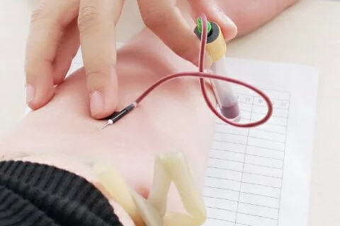 检查孕酮和hcg需要空腹吗