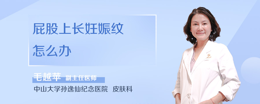 屁股上长妊娠纹怎么办