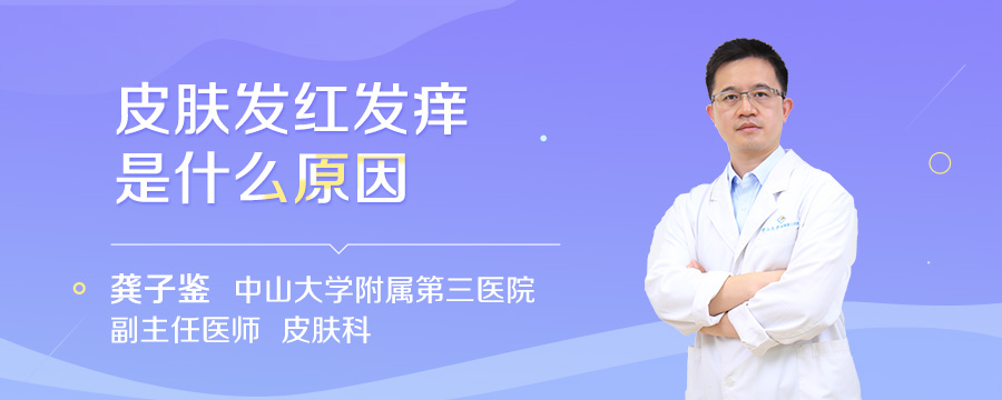 皮肤发红发痒是什么原因