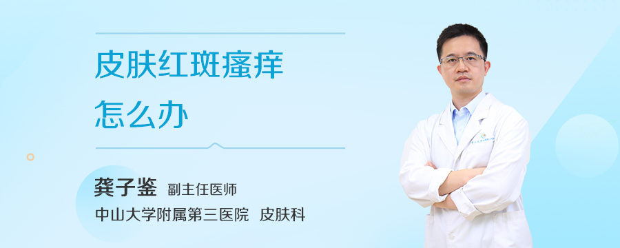 皮肤红斑瘙痒怎么办