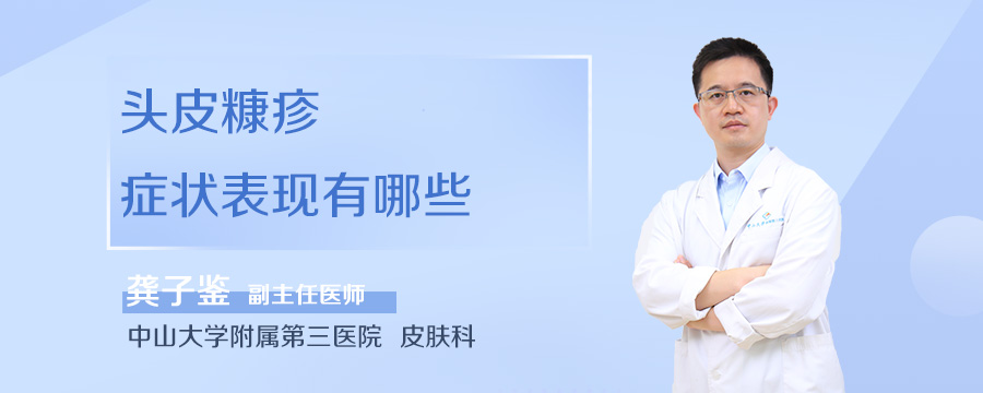 头皮糠疹症状表现有哪些
