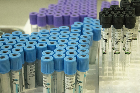 甲胎蛋白多少为正常