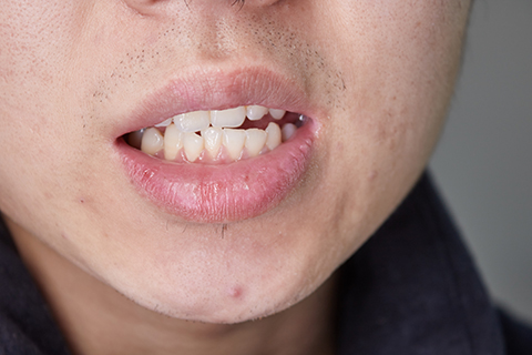 嘴唇麻是怎么回事 嘴唇麻是怎么回事