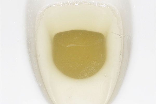 尿蛋白是指尿液里的蛋白质含量，尿蛋白数值可以反应肾脏健康