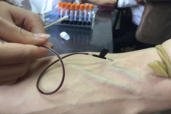 随着人们健康意识的提高，人们会定期体检去排查一些疾病