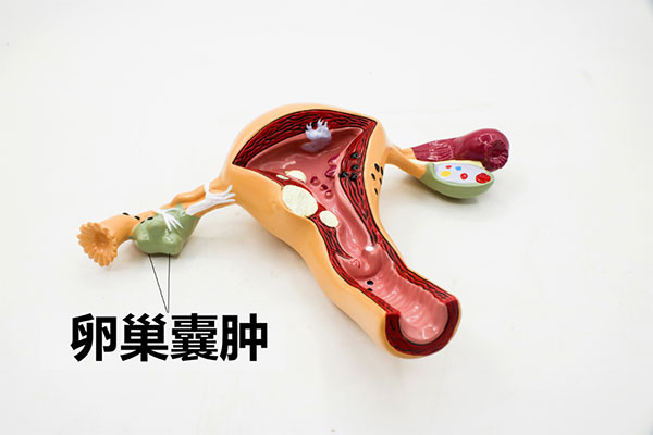 卵巢对女性非常的重要，是女性最重要的器官之一