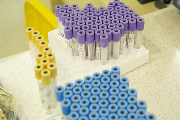 在尿常规检查的时候，很多人会出现检查结果中白细胞一个加号的情况