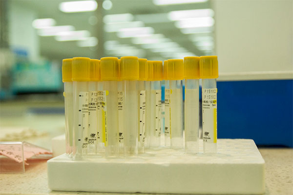 酮体可能许多人都不太了解，其实这就是尿常规检查时会出现的一个指标