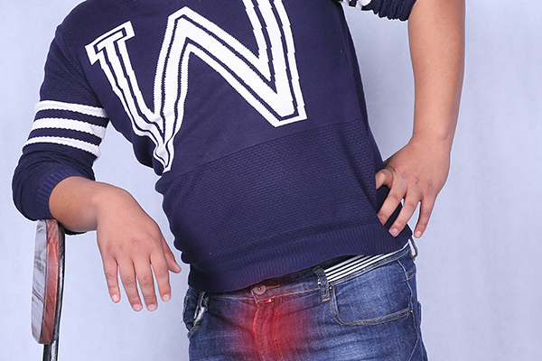 急性睾丸炎是男性较为常见的一种疾病，很多人患上这种疾病，却不知道是何因素