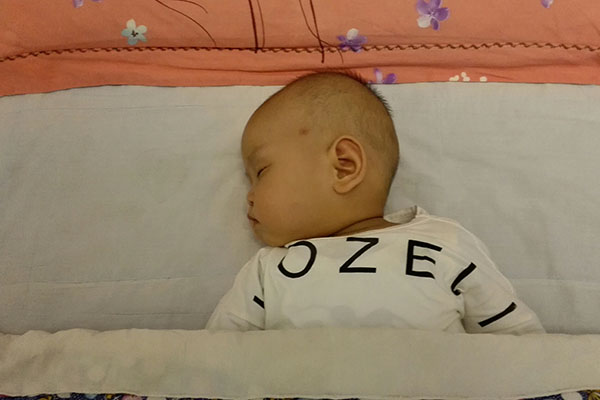 新生儿得溶血症，很容易黄上黄疸，也会加重贫血症状，影响身体生长发育