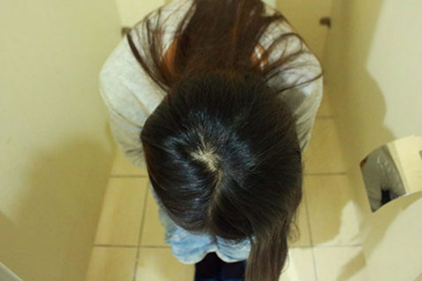 生活中很多人在排便的时候，会有大便带血的情况