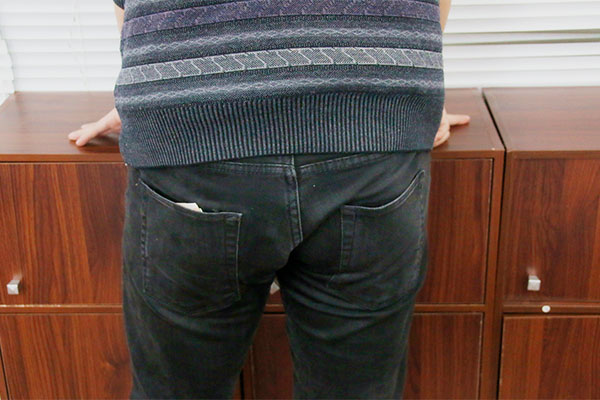 痔疮相信许多人都知道，这是一种常见的疾病，有许多人都得过这种疾病