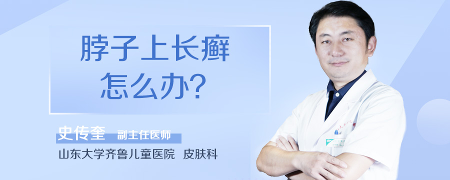 脖子上长癣怎么办