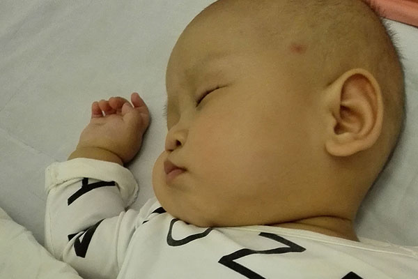 宝宝7个月的时候感冒发烧，在症状不严重的情况下，尽量不要吃药治疗