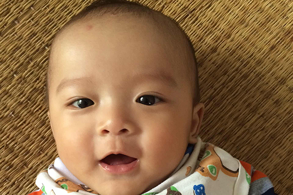 宝宝的眼睛发育是比较迟缓的，在出生之后需要经历一段时间之后才能够发育完全