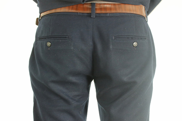 大便干出血很可能是痔疮的表现。