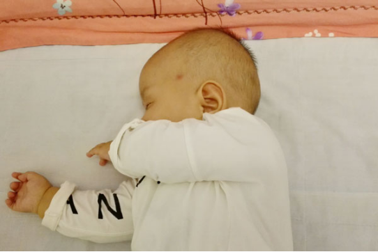 想要判断宝宝是不是方颅，可以从孩子的头型来判断