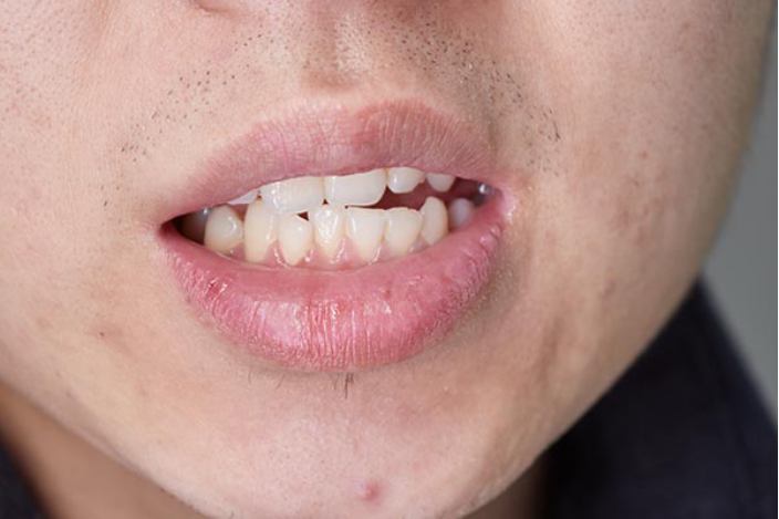 口腔正常温度在36.3度到37.2度范围内