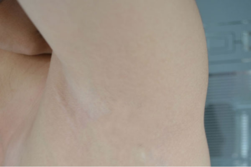 腋下的体温通常都是在36-37度之间的。