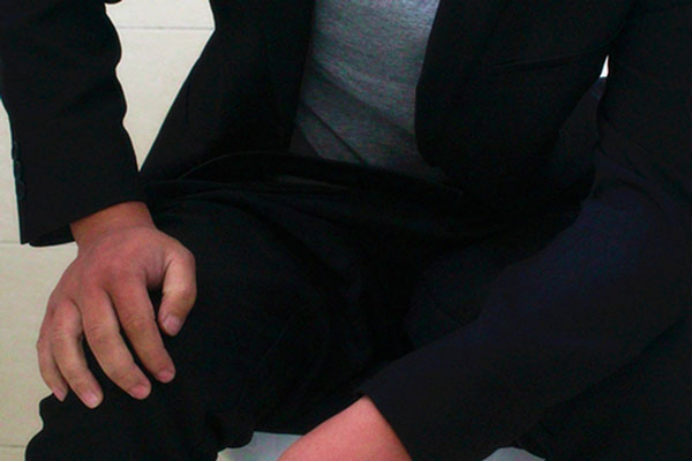 引起便秘的原因包括遗传因素以及饮食因素