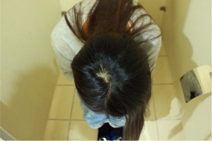 可以采取多喝水或者吃东西来刺激肠道蠕动方式缓解