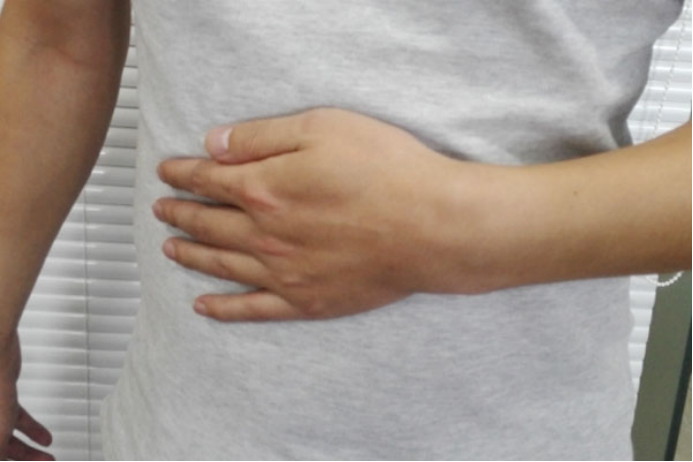 主要症状有上腹疼痛、呕吐、腹泻等