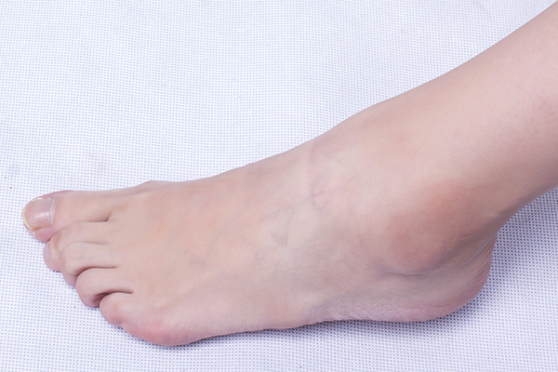 脚心发热多半是由于饮食不当引起的，如果是饮食不规律，就很容易对脾胃造成伤害，从而容易出现积食的情况