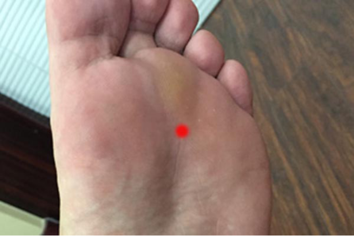 脚出汗是肾虚吗