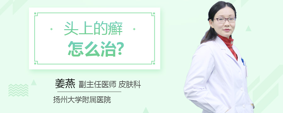 头上的癣怎么治