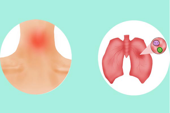 呼吸道感染可以自愈吗