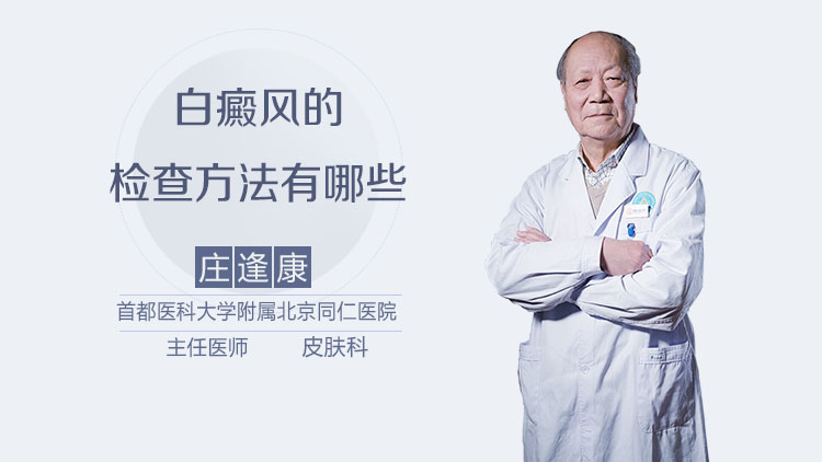 白癜风的检查方法有哪些
