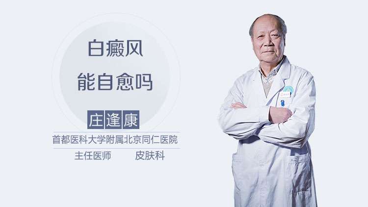 白癜风能自愈吗