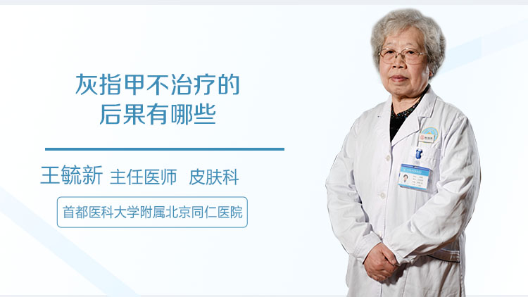 灰指甲不治疗的后果有哪些