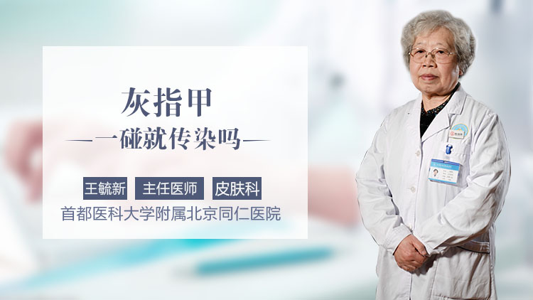 灰指甲一碰就传染吗