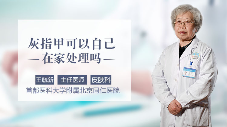 灰指甲可以自己在家处理吗