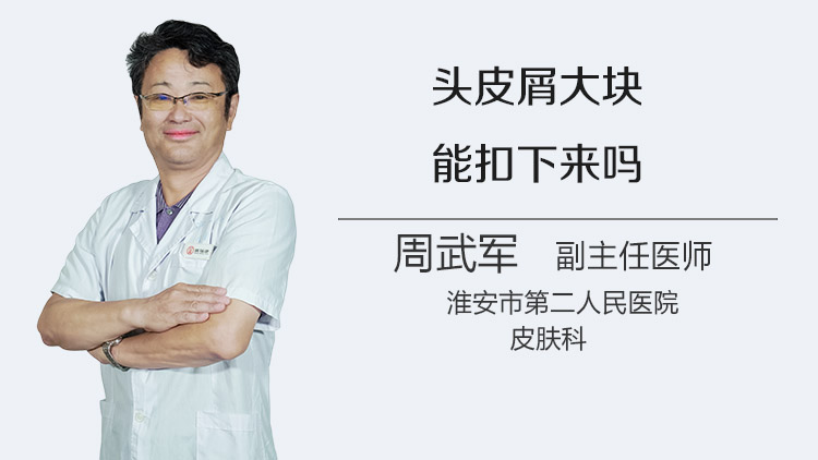 头皮屑大块能扣下来吗