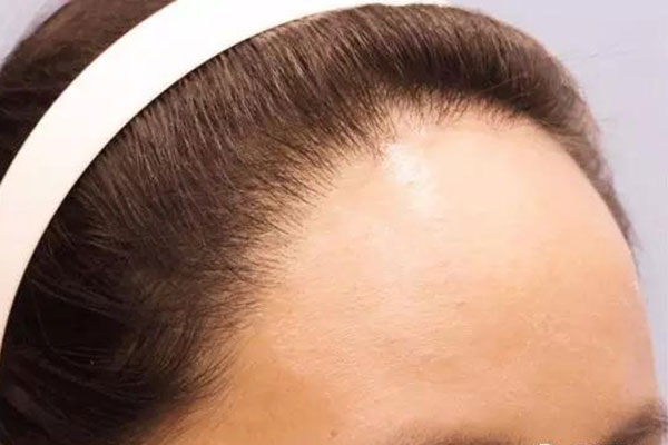 身体疾病 不同部位的汗代表不同的病