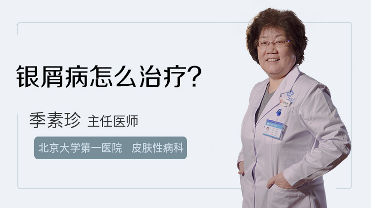 银屑病怎么治疗