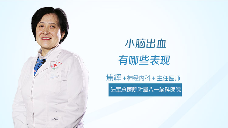 小脑出血有哪些表现