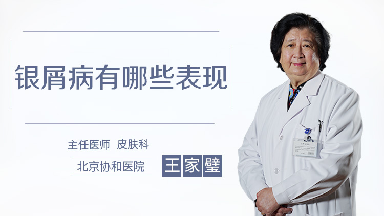 银屑病有哪些表现